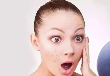 Làm thế nào để loại bỏ viêm da dầu?
